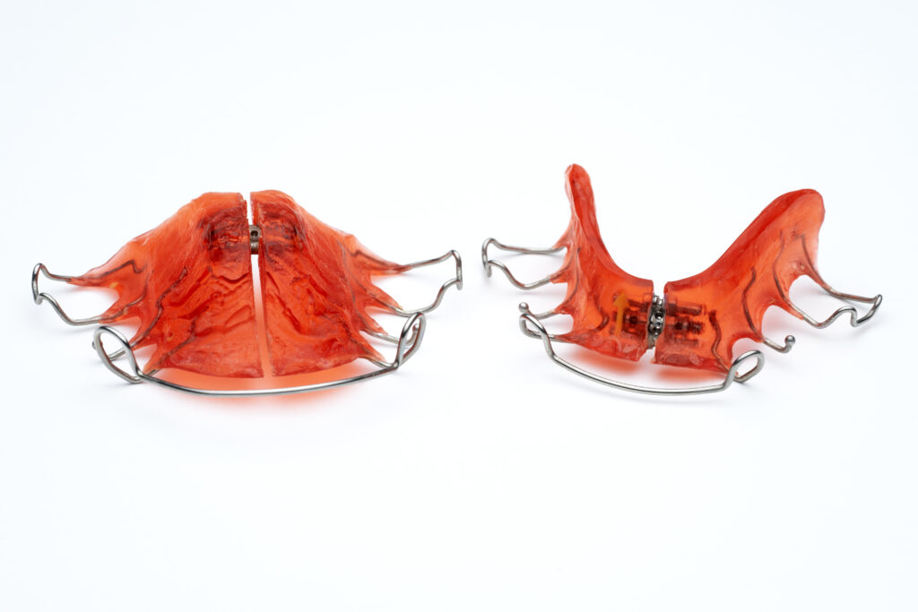 Orthodontic Expanders and Expansion: A Comprehensive Guide